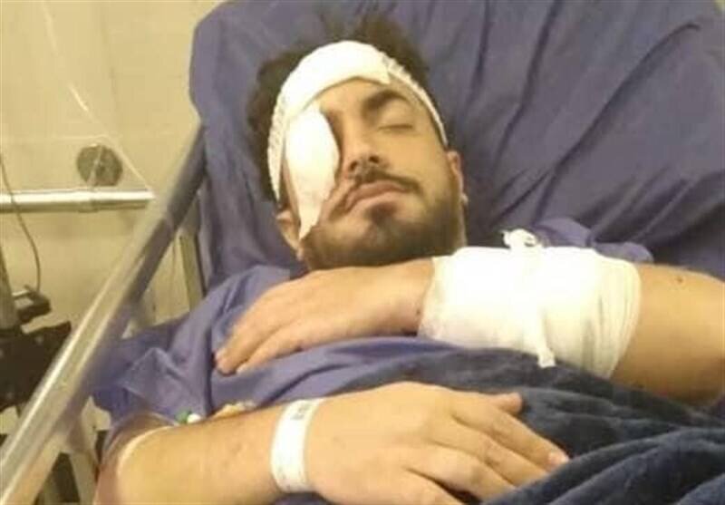سياست     سیاست داخلی  مجموع نظرات: ۱۵۸ دوشنبه ۲۷ تیر ۱۴۰۱ – ۰۹:۱۶ ۲ نفر  عکس | حمله به یک روحانی در تهرانپارس؛ انتقال به بیمارستان | ورزش صبحگاهی تبدیل به حمام خون شد